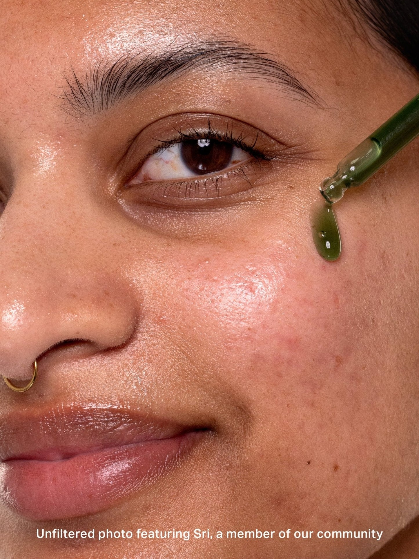 chlorophyll discoloration serum