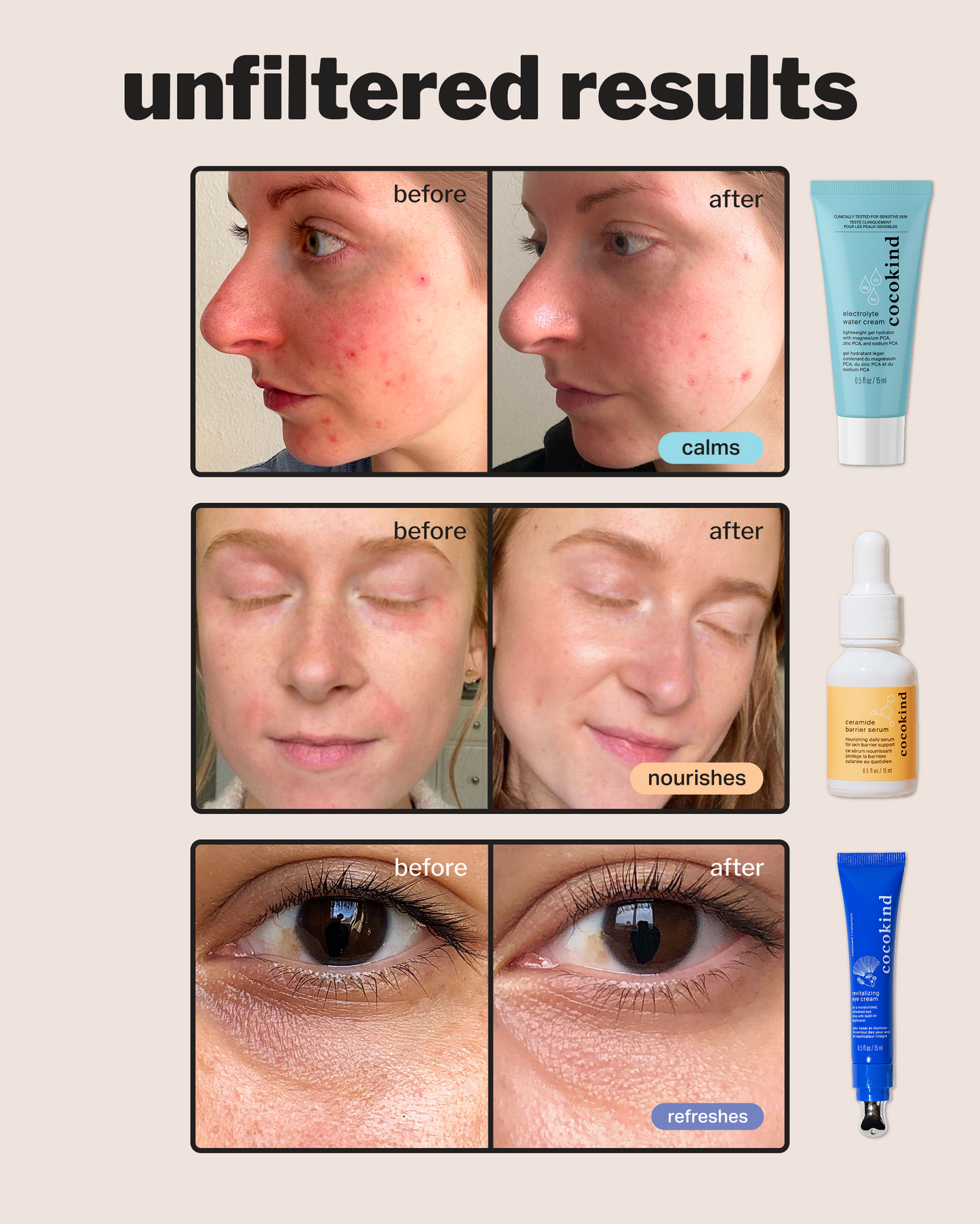 hydration heroes set