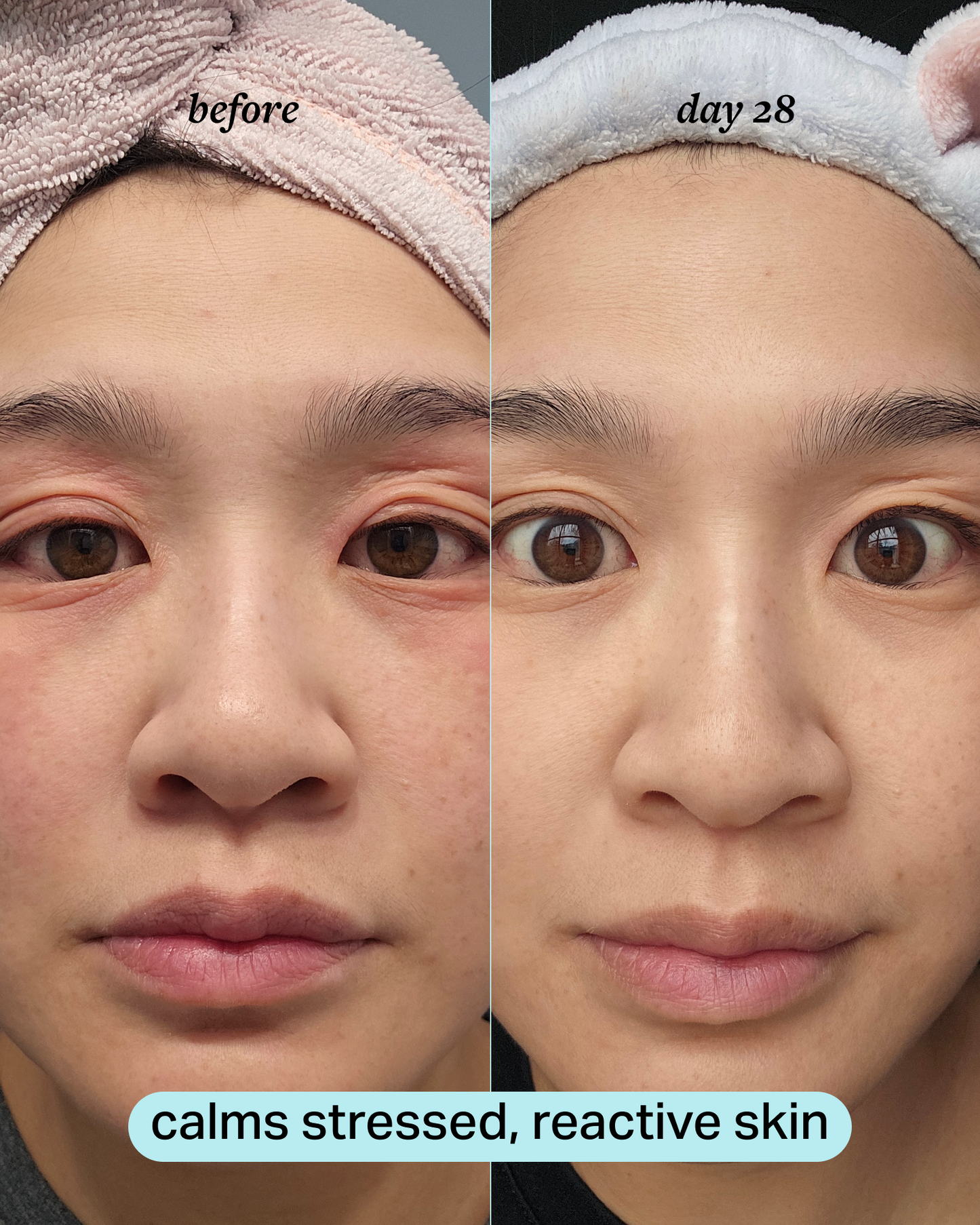 calming magnesium mist