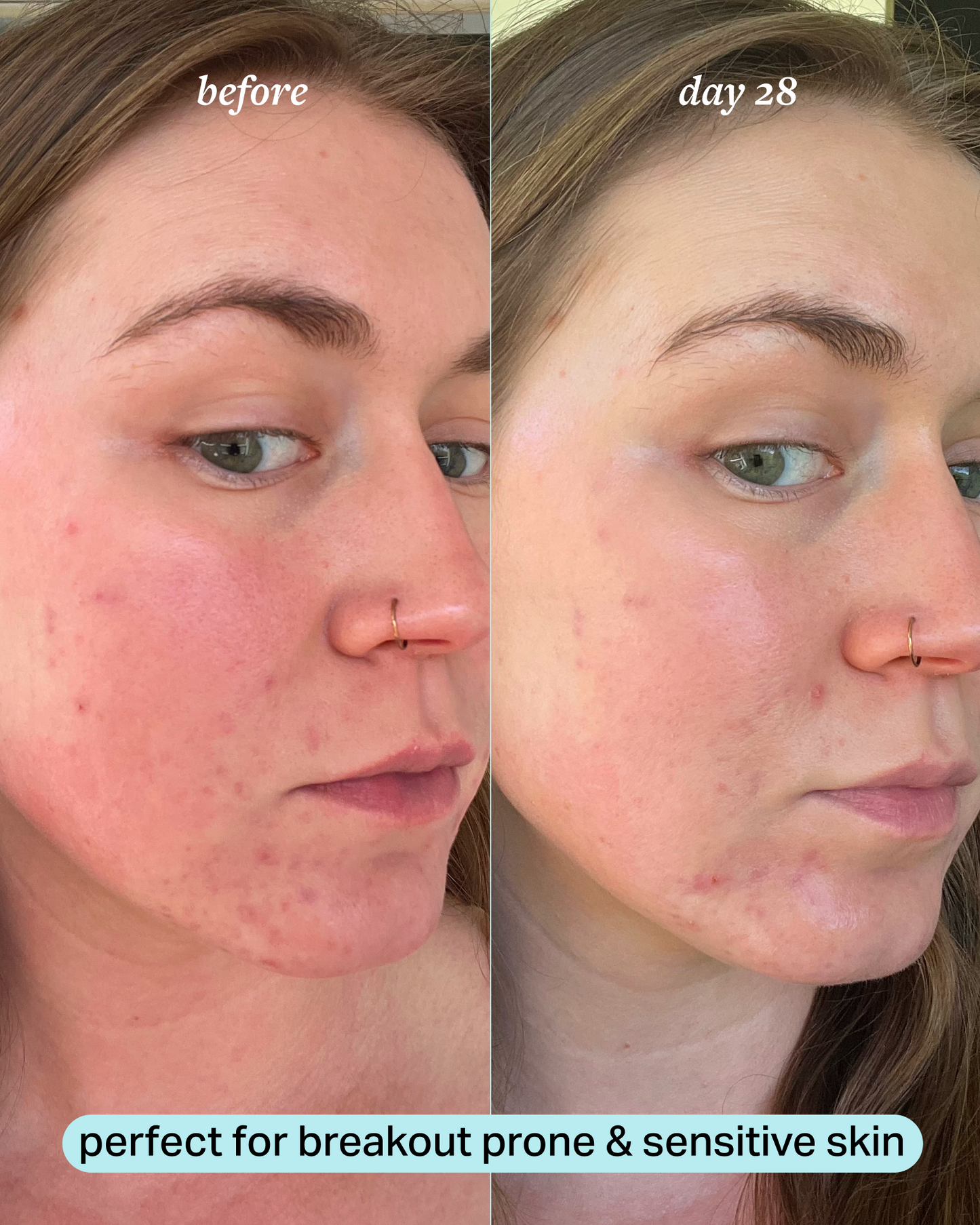 travel-size calming magnesium mist