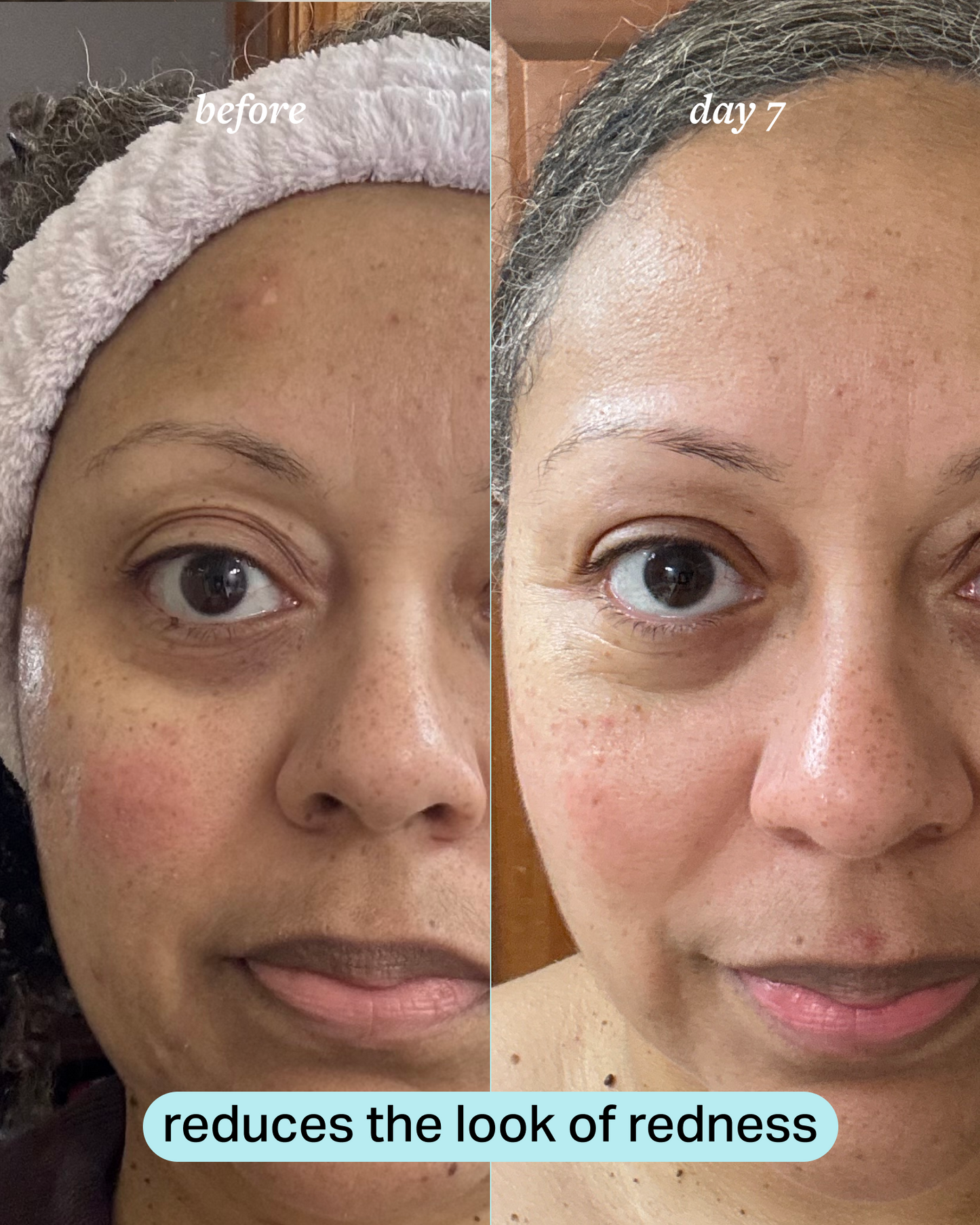 calming magnesium mist