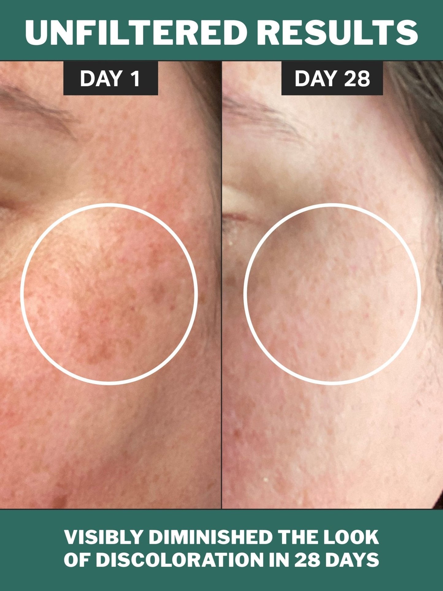 chlorophyll discoloration serum