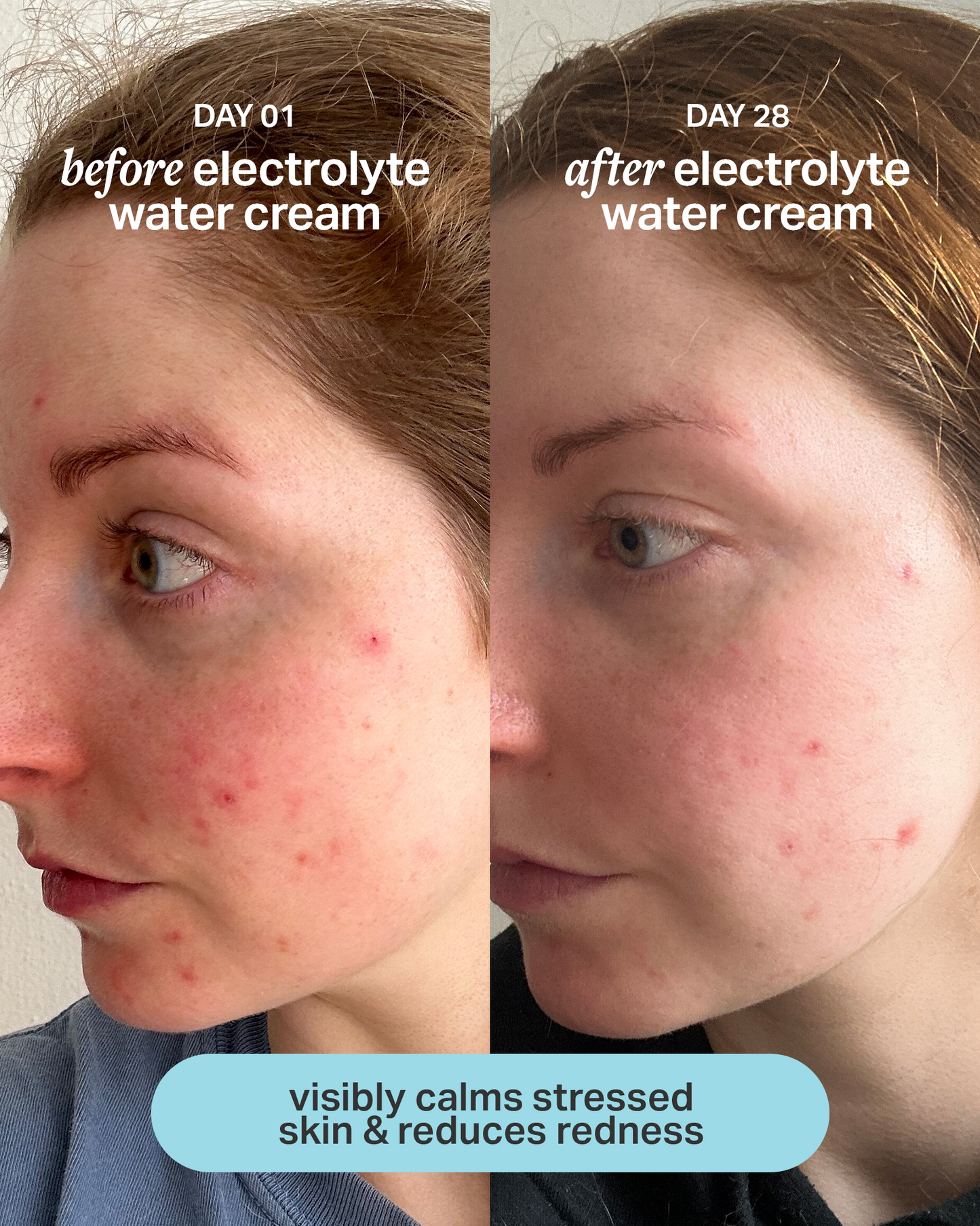 electrolyte water cream